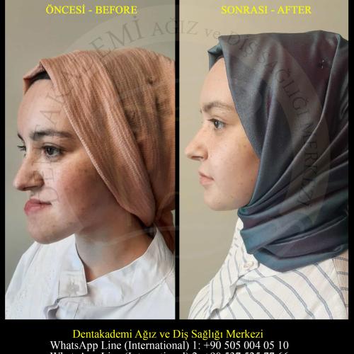 Before after photos of our patients 4